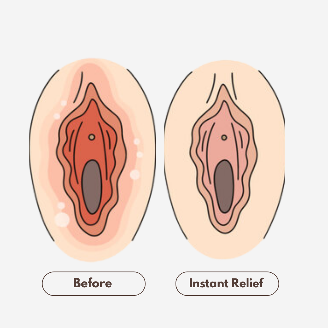 Postpartum PerinealComfort Spray
