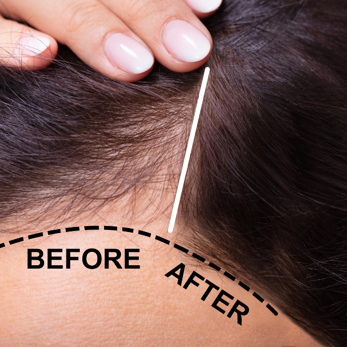 Postpartum HairFix Serum