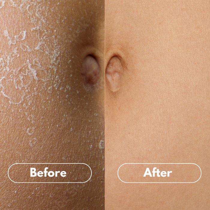 ComfortBelly Soothing Oil
