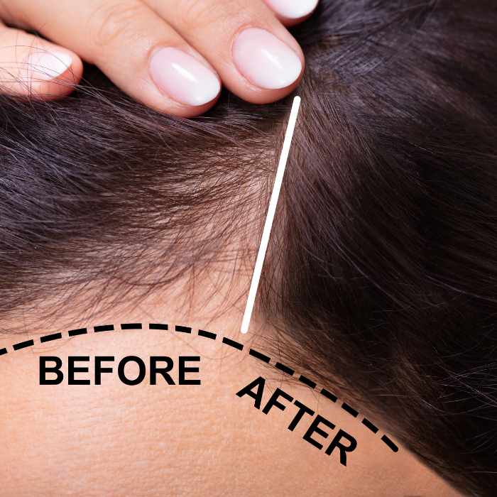 Postpartum HairFix Serum